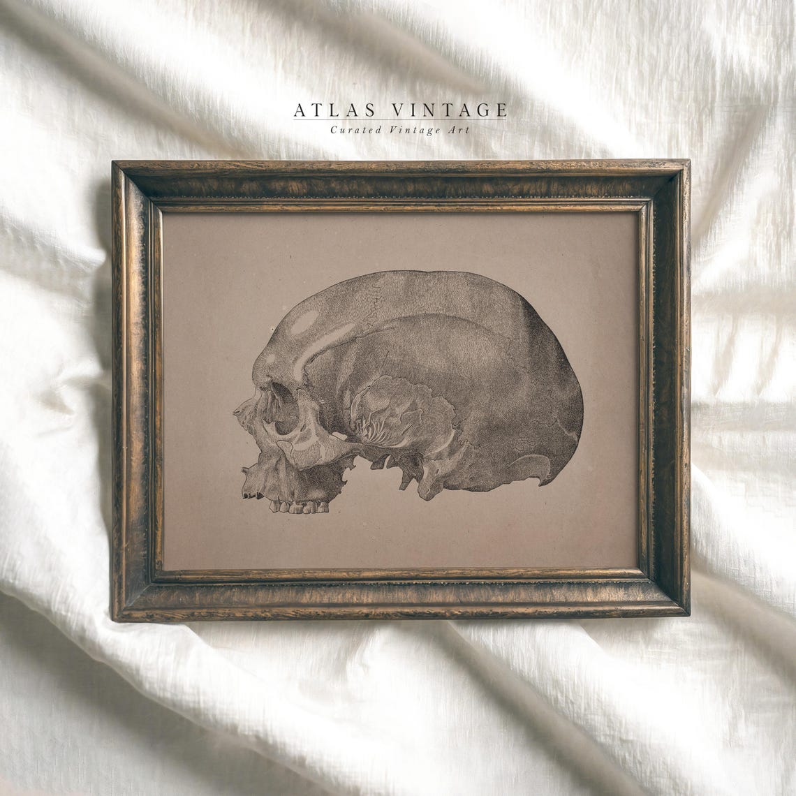 Vintage Skull Anatomy Sketch Sepia Medical Illustration Poster