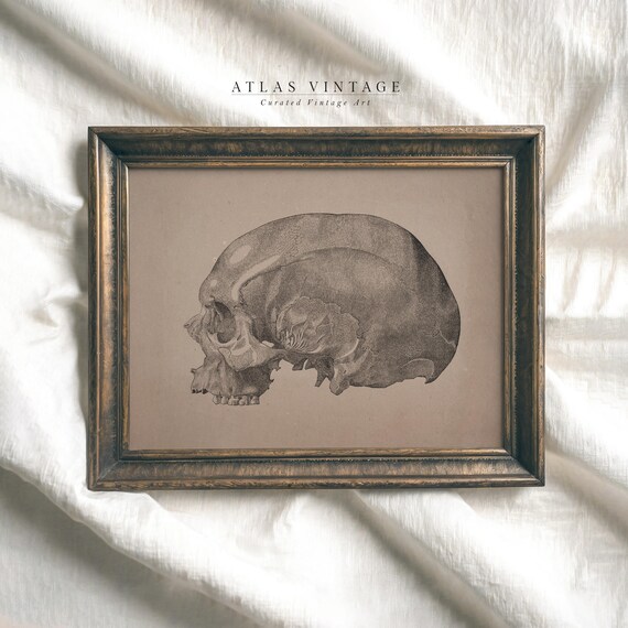 Vintage Skull Anatomy Sketch Sepia Medical Illustration Poster