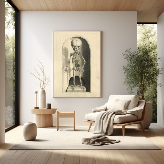 Antique Child Skeleton Lithograph Wall Art Antique Medical Poster Print