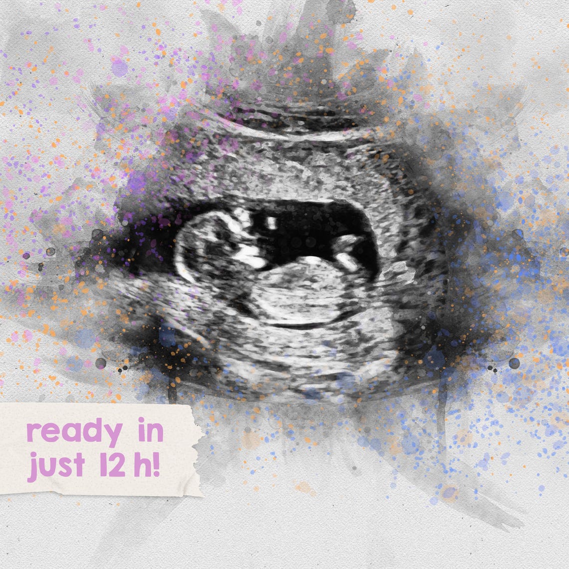 Baby Ultrasound Art Watercolor Sonogram Pregnancy Keepsake Poster