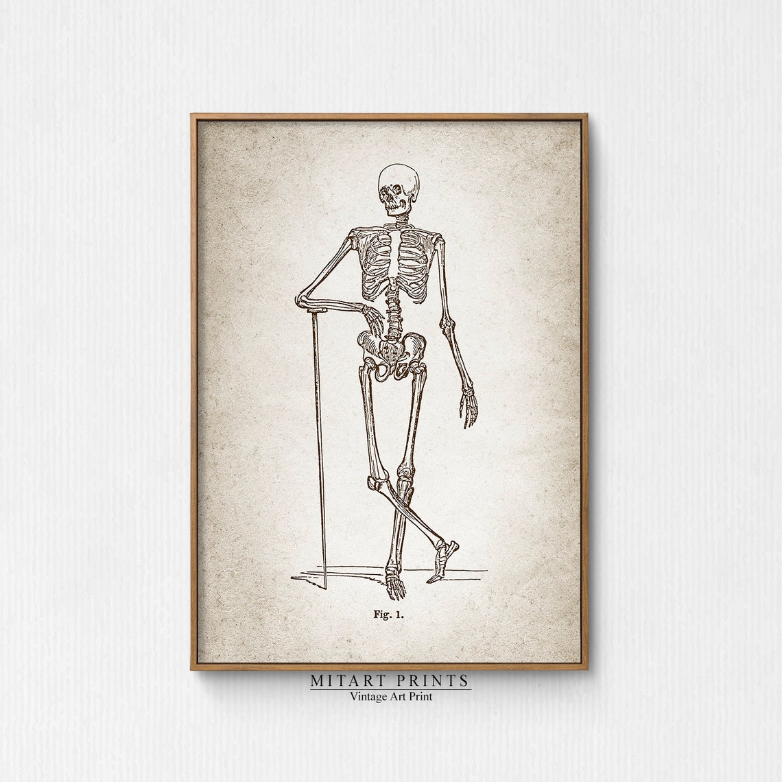 Vintage Anatomical Skeleton with Cane Walking Fig. 1 Engraving Poster - Image 3