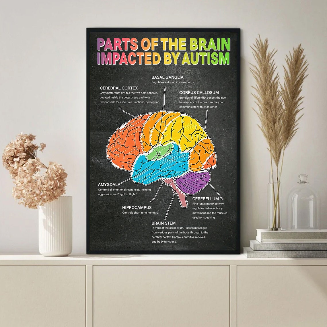 Parts of the Brain Impacted by Autism Educational Chart Poster - Image 4