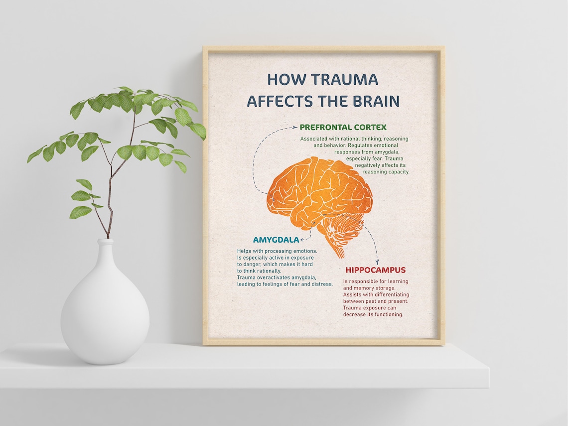 How Trauma Affects The Brain, Vintage Art Print - Image 2