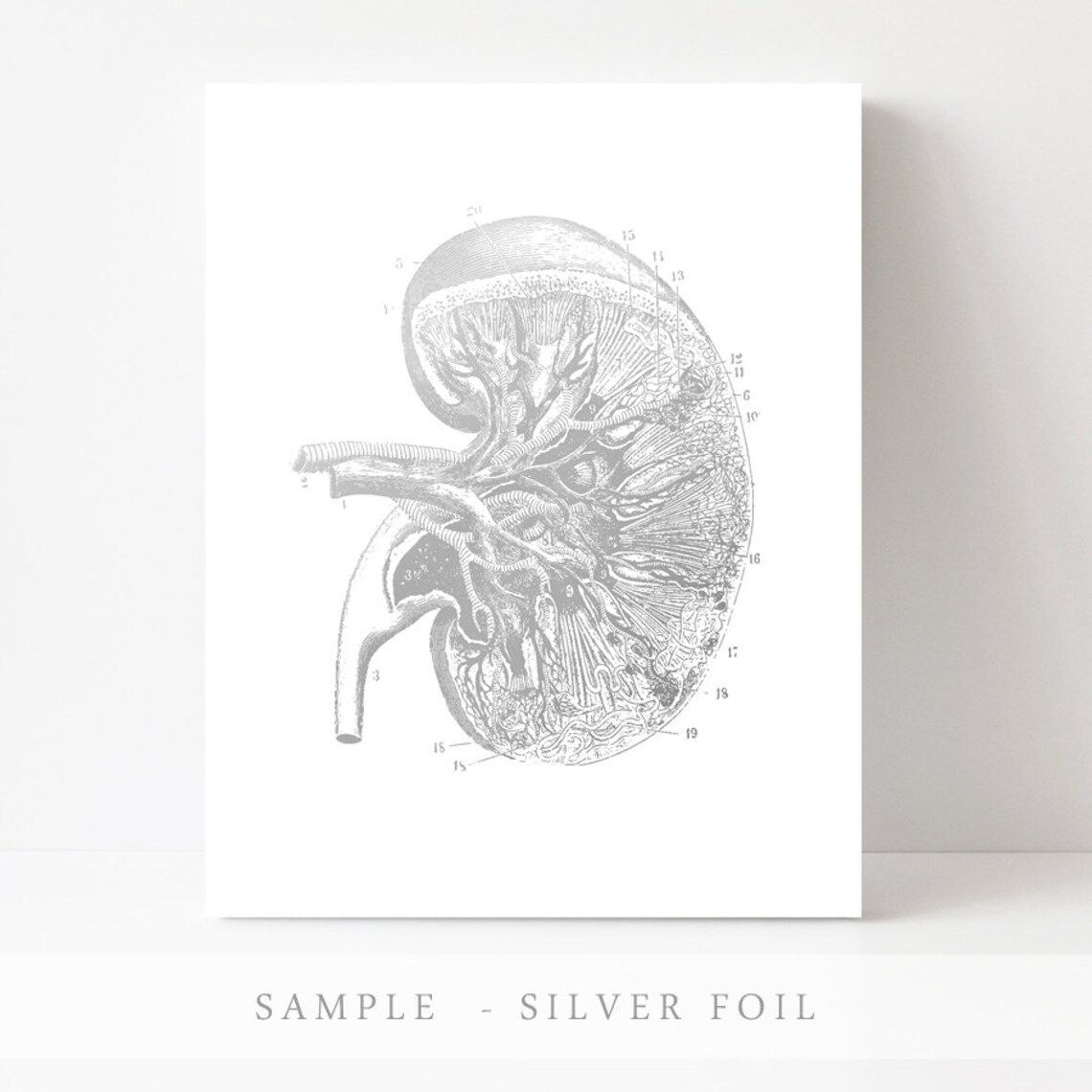 Kidney Transplant Anatomy Art Gold Print Kidney Art Kidney Donor Gift Kidney Transplant Gift Kidney Cancer Doctor Nephrologist - Image 3