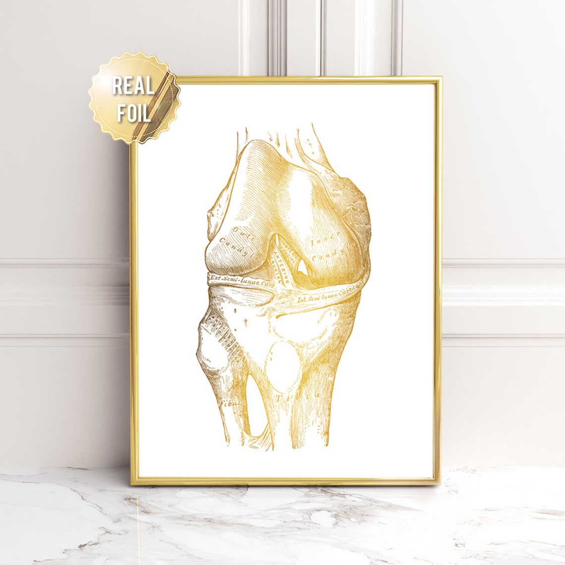 Orthopedic Surgeon Knee Anatomy Gold Foil Print Physical Therapist Gifts Medical Art Gift For Doctor Gift For Surgeon Anatomy Art