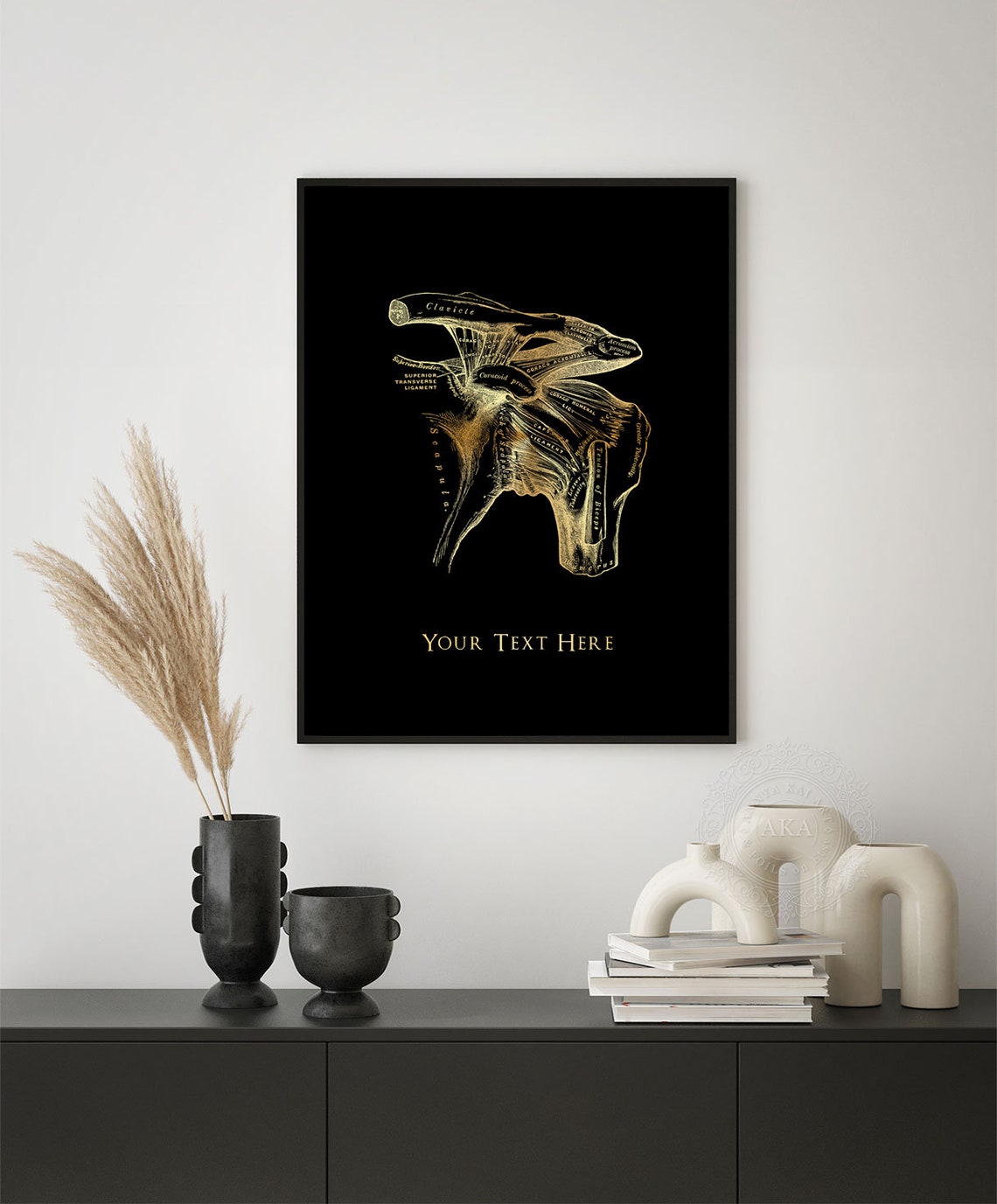 Personalized Shoulder Anatomy Gold Foil Orthopedic Surgeon Wall Print - Image 5