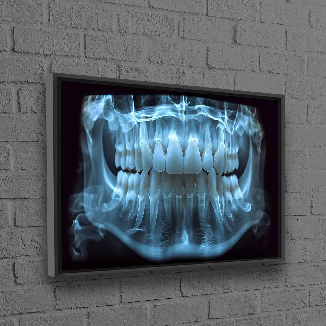 Dental X-Ray Teeth Panoramic Medical Office Decorative Poster