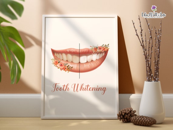 Tooth Whitening Dental Assistant Tooth Art Dental Art Dentist Gift Dental Hygienist Dentistry Art Dental Clinic Dcor Dental Anatomy Art