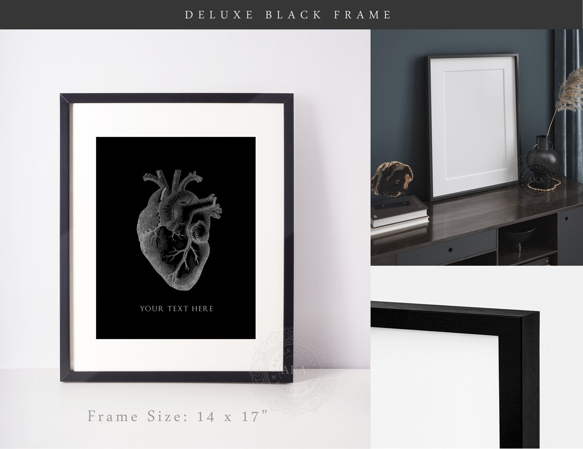 Custom Anatomical Heart Art Print for Cardiology - Image 2