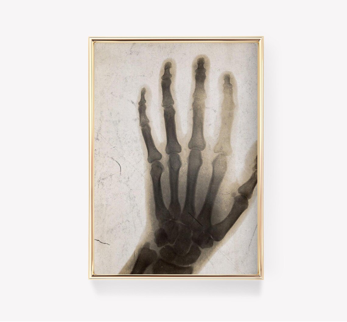 Xray Hand Vintage Medical Poster Art Print