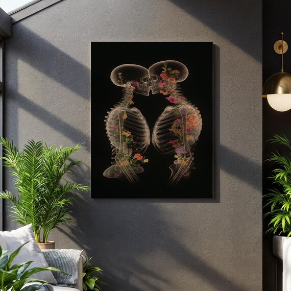 Skeleton Lovers Floral Wall Art Romantic Xray Kiss Anatomy Canvas Gothic Botanical Print For Alternative Couples Or Unique Home Decor