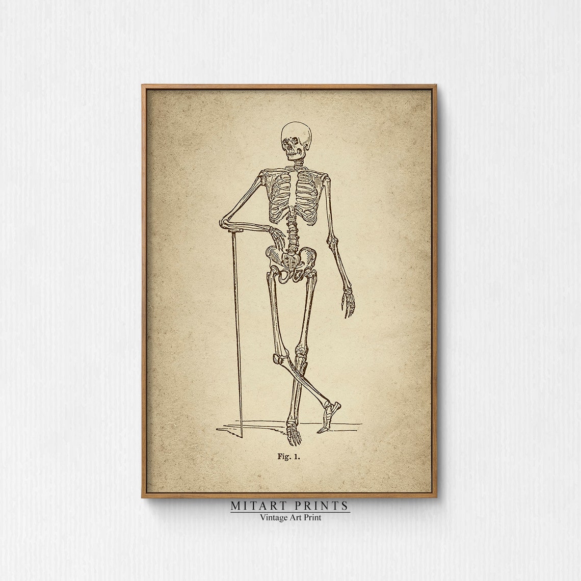 Vintage Anatomical Skeleton with Cane Walking Fig. 1 Engraving Poster