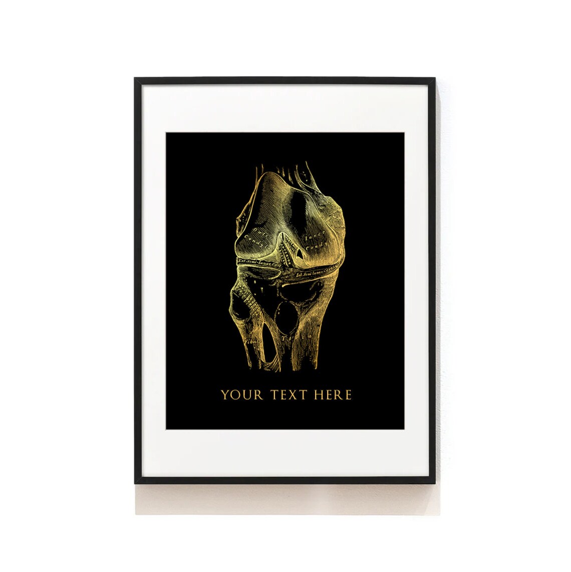 Personalized Surgeon Gold Anatomy Wall Art Print - Image 4