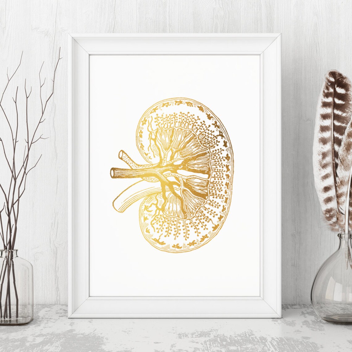 Kidney Anatomy Gold Foil Medical Art Doctor Office Decor Wall Art