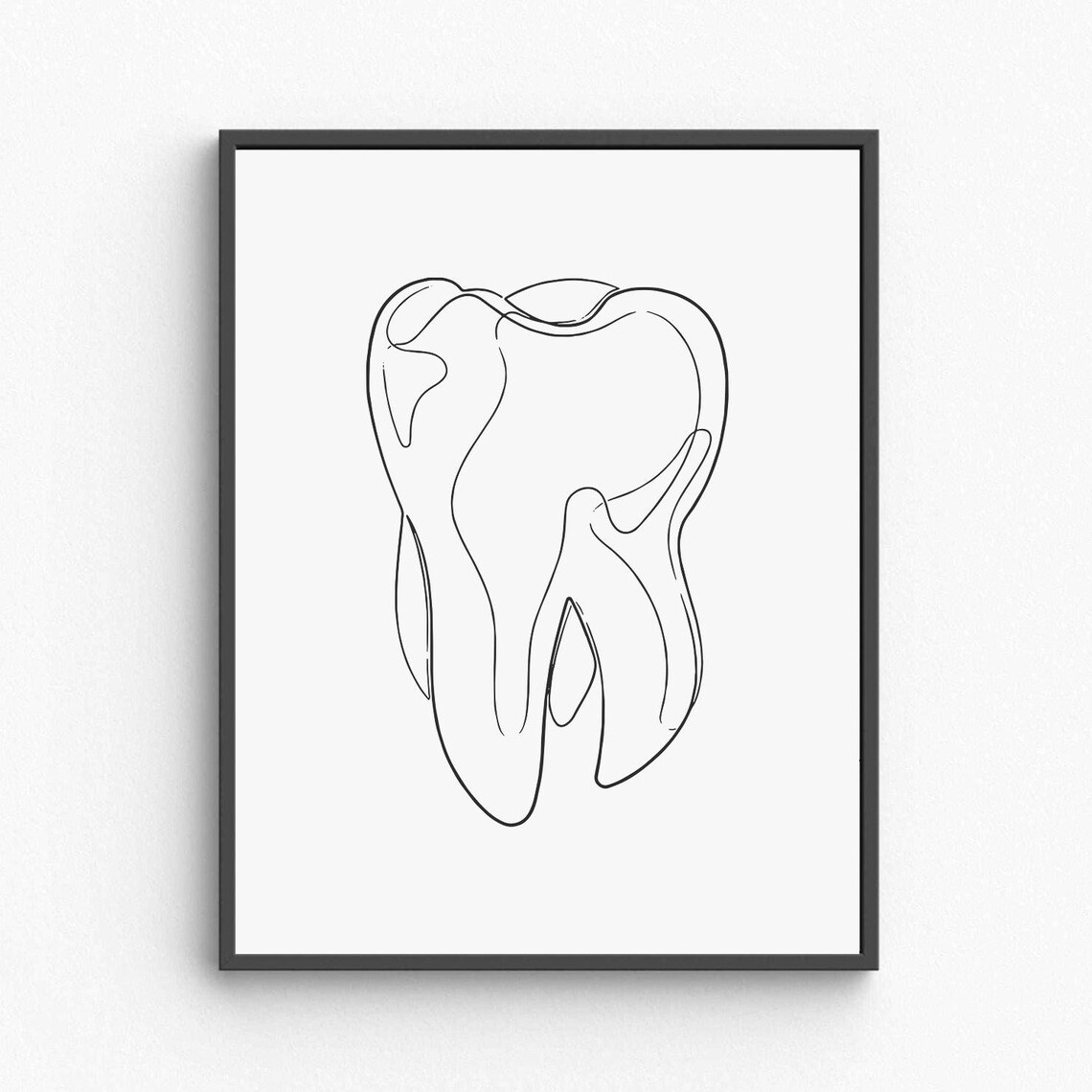 Tooth Molar Line Art Dental Anatomy Minimalist Medical Poster