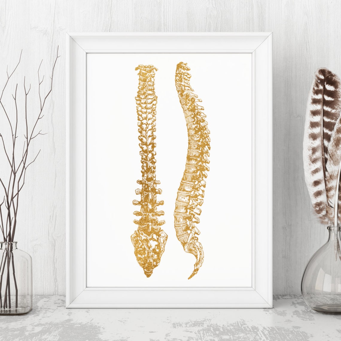 Spine Anatomy Gold Foil Chiropractor Medical Vintage Wall Art - Image 3