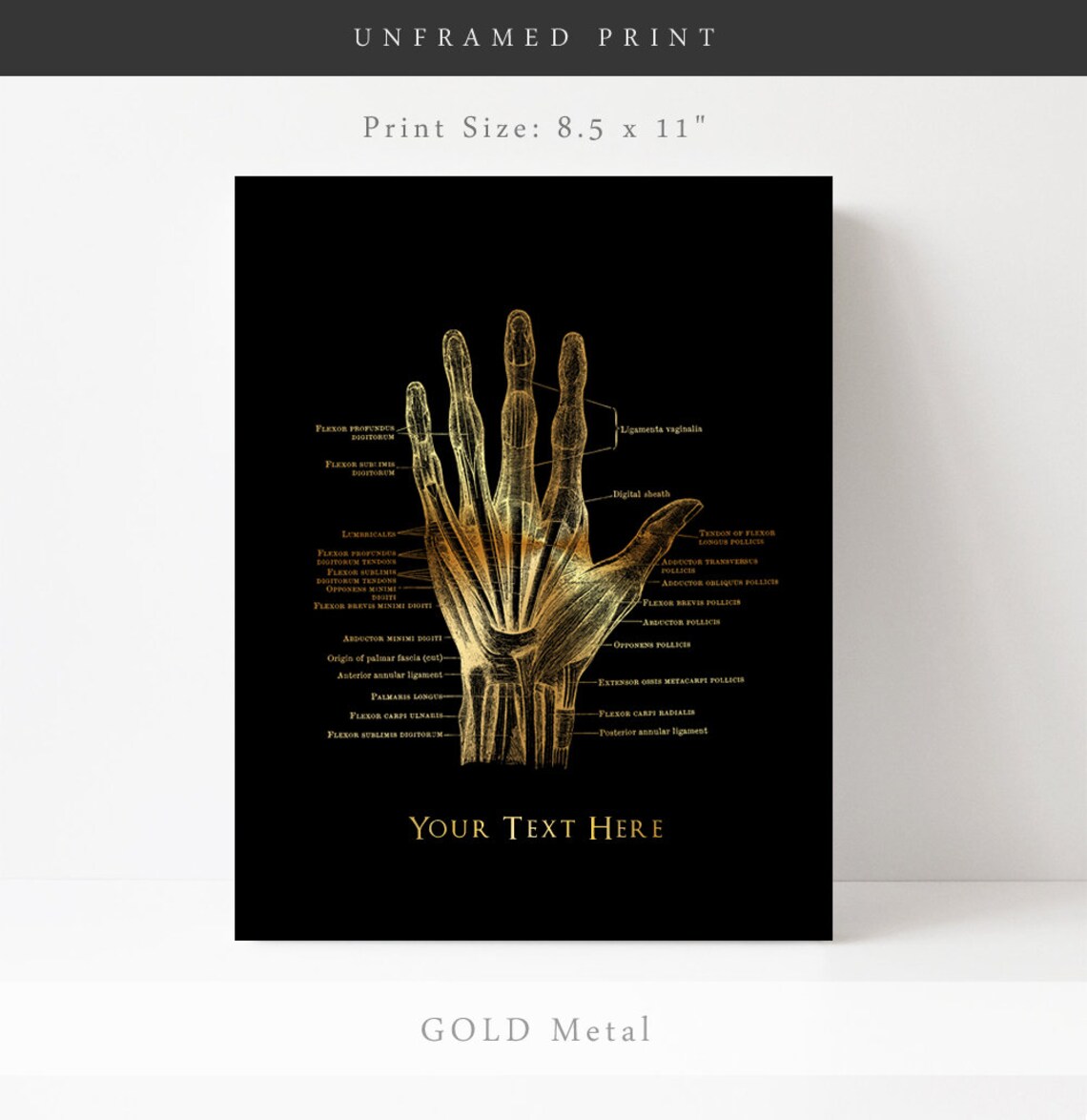 Personalized Hand Anatomy Art Print, Orthopedic Gift - Image 3