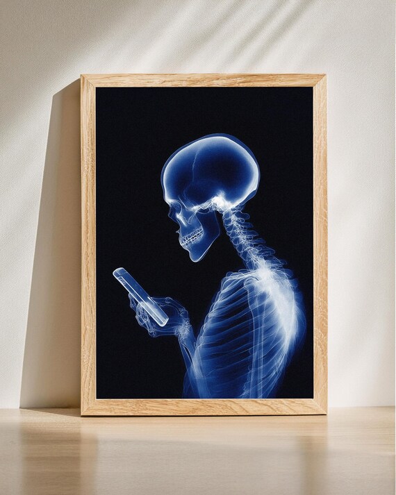 Addiction Wall Art Xray Skeleton Print Modern Society Poster Technology Critique Artwork Provoking Home Decor