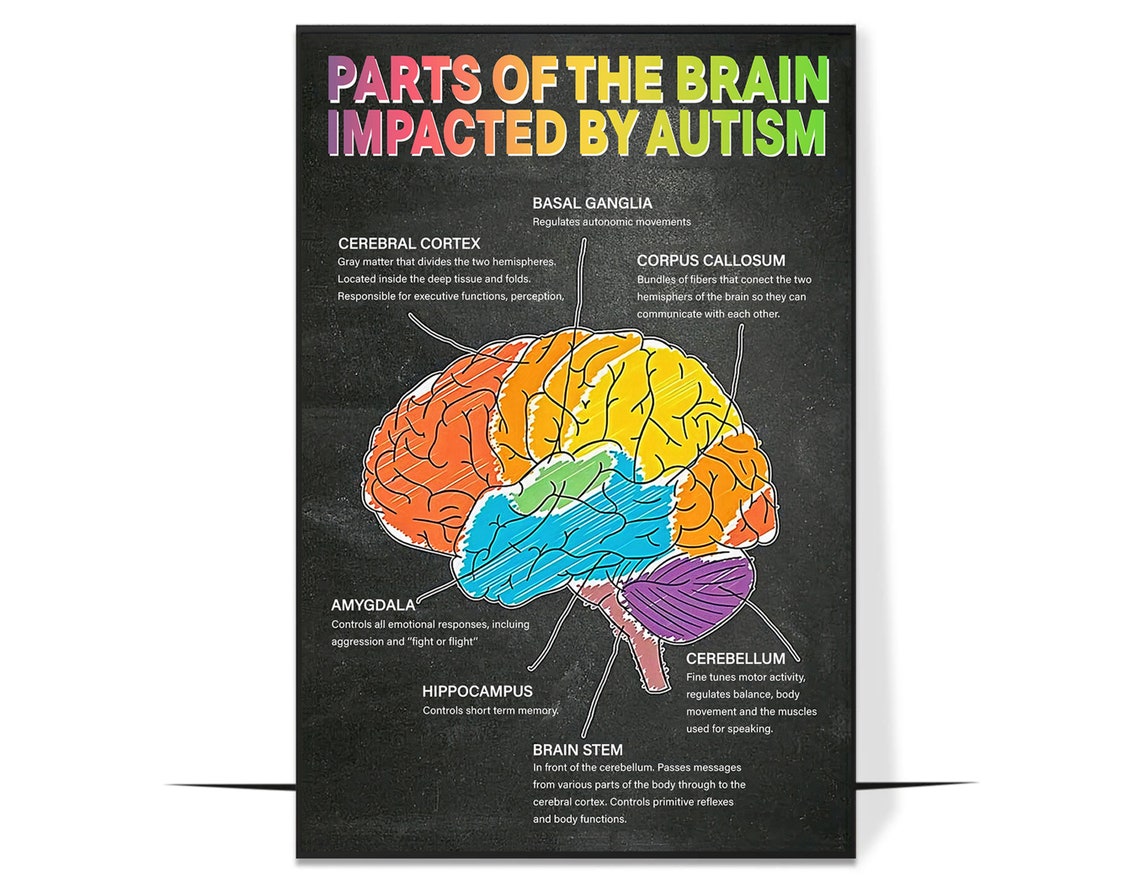 Parts of the Brain Impacted by Autism Educational Chart Poster