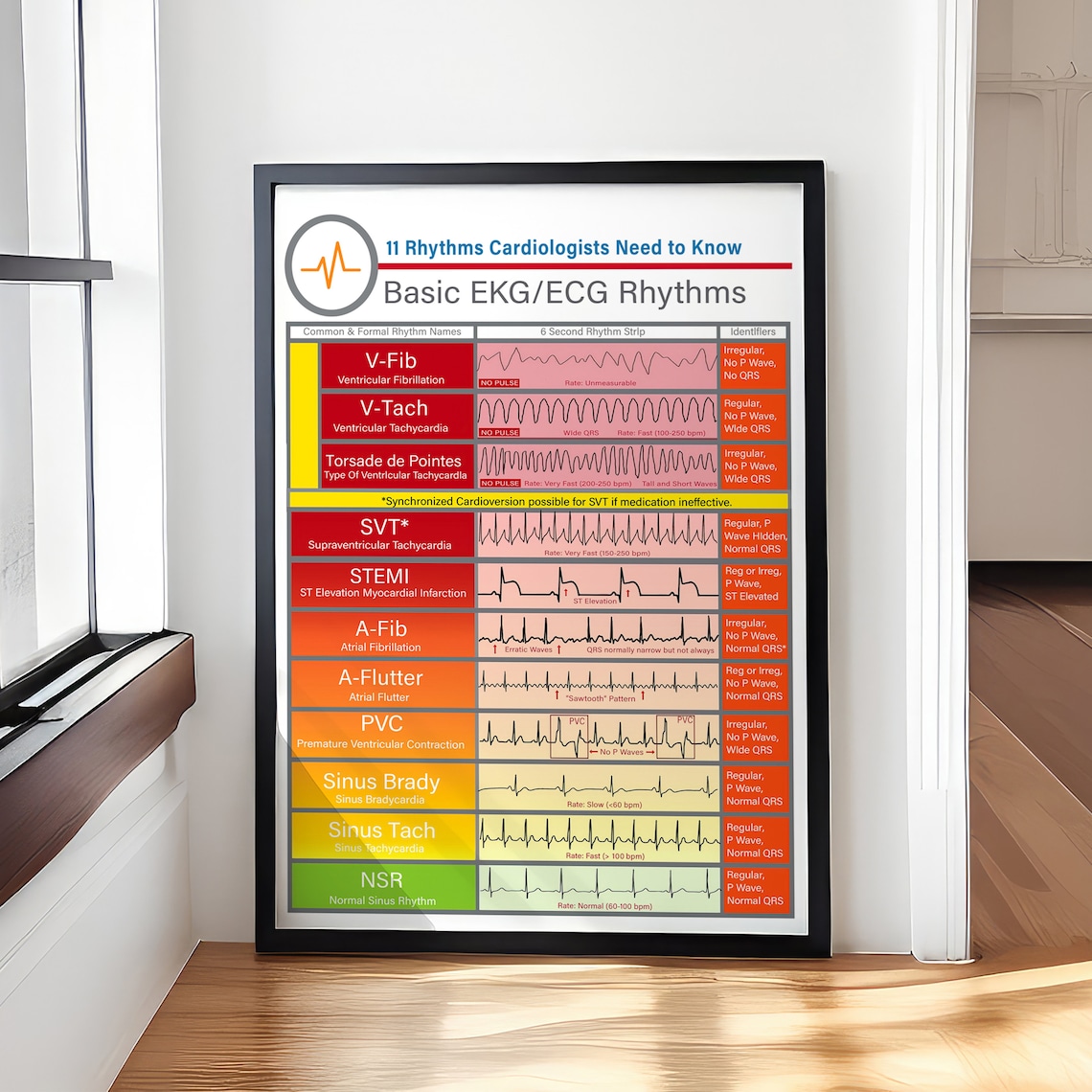 Basic EKG ECG Rhythms Knowledge Vintage Poster