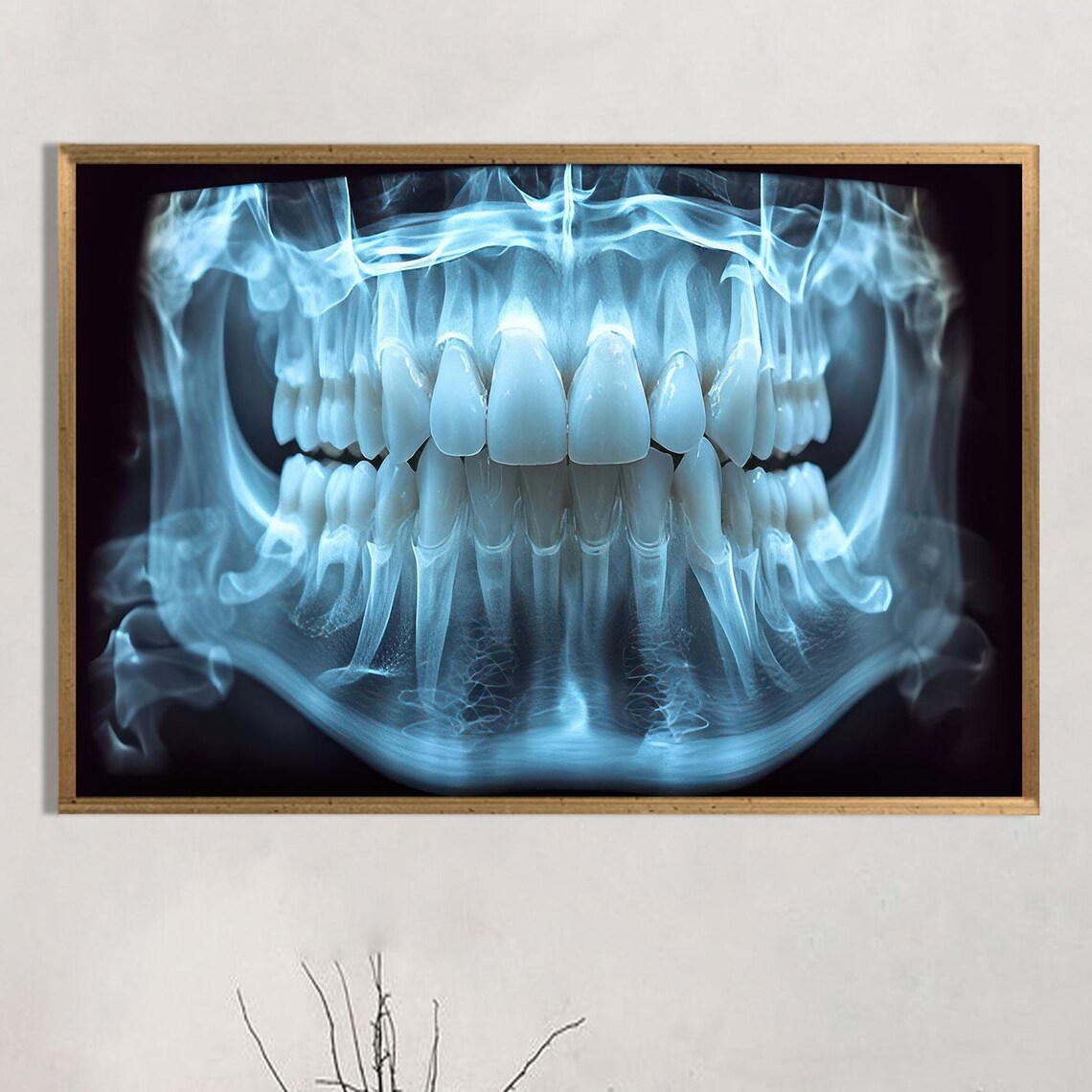 Dental Panoramic X Ray Teeth Scan Blue Medical Office Wall Poster