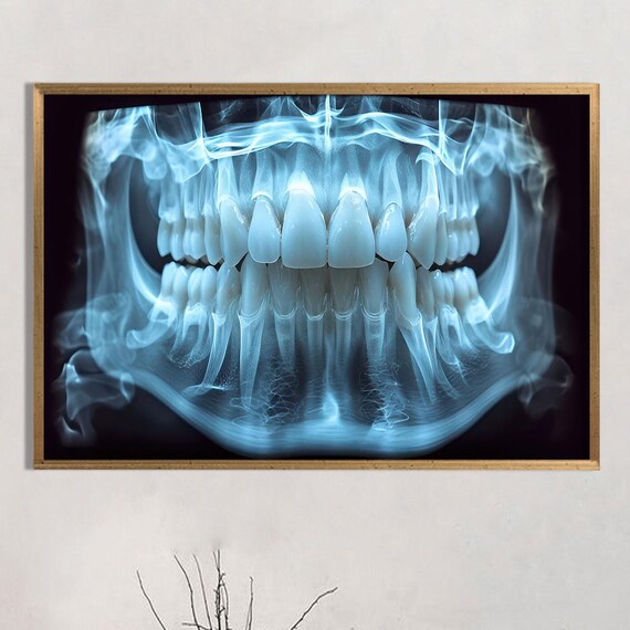 Dental Panoramic X Ray Teeth Scan Blue Medical Office Wall Poster