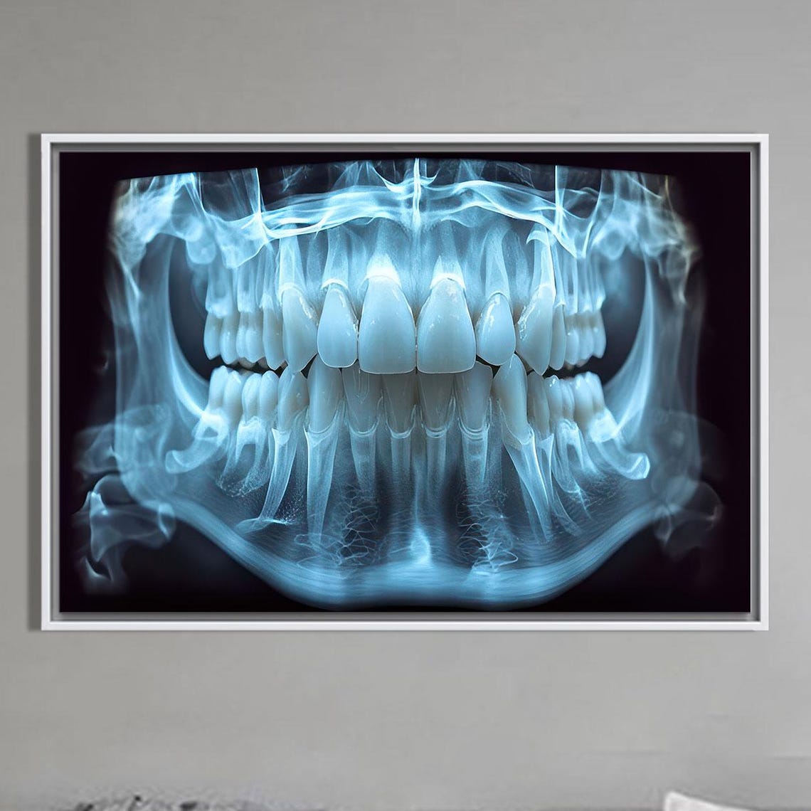 Panoramic Dental X Ray Teeth Radiograph Blue Anatomy Art Poster