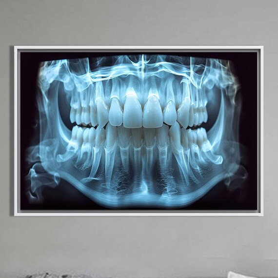 Panoramic Dental X Ray Teeth Radiograph Blue Anatomy Art Poster
