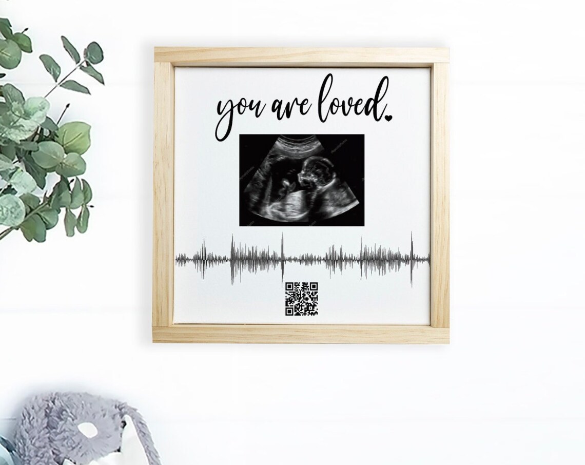 Custom Ultrasound QR Code Soundwave Art Print