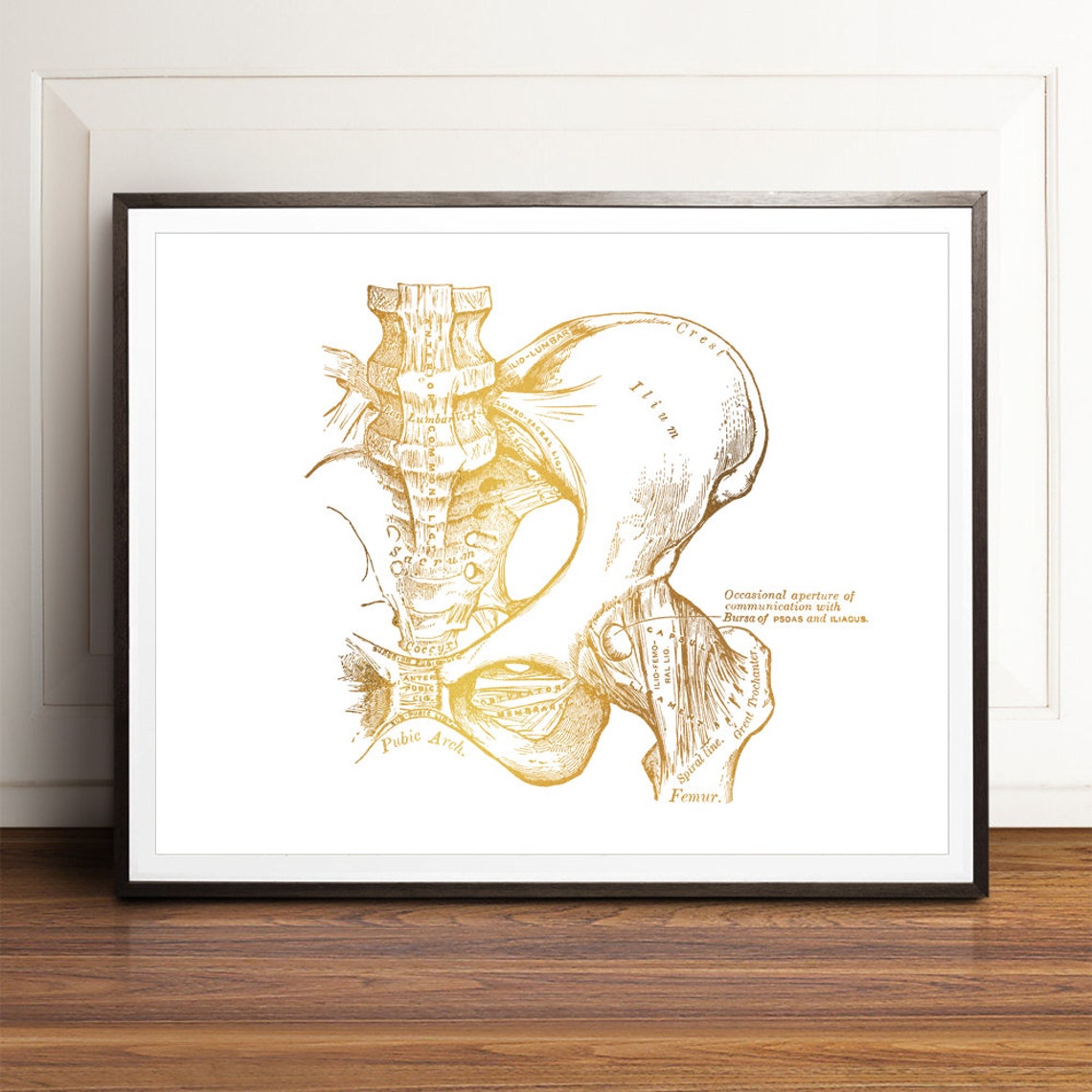 Gold Foil Pelvis Hip Bone Anatomy Vintage Orthopedic Art Print