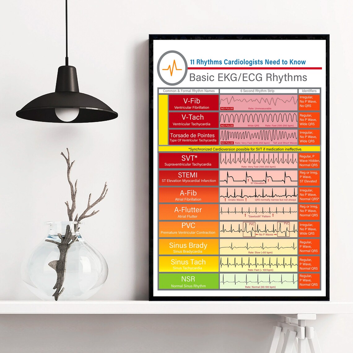 Basic EKG ECG Rhythms Knowledge Vintage Poster - Image 4