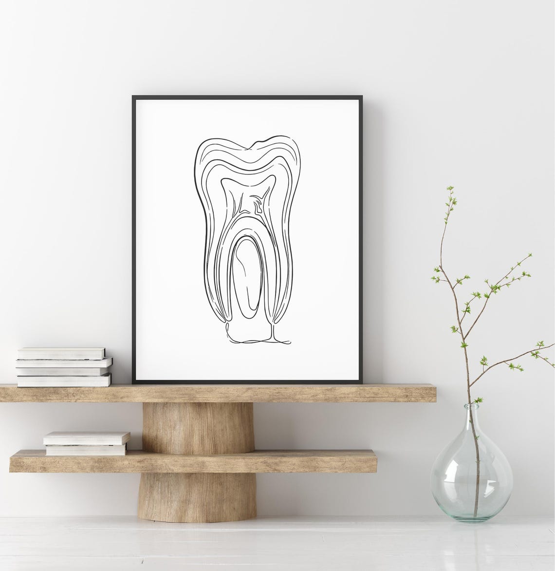 Tooth Anatomy Line Art Dental Medical Illustration Minimalist Poster - Image 2