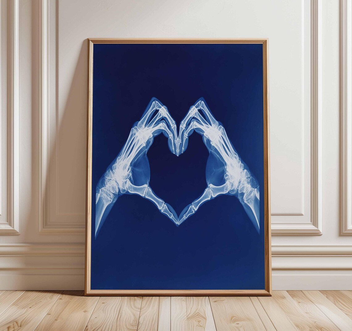 Xray Heart Hands Poster, Anatomical Medical Print