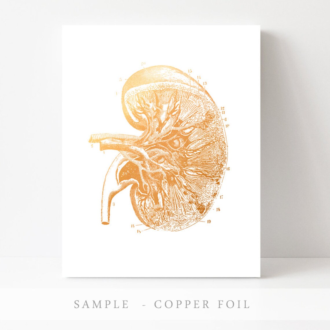 Kidney Transplant Anatomy Art Gold Print Kidney Art Kidney Donor Gift Kidney Transplant Gift Kidney Cancer Doctor Nephrologist - Image 2