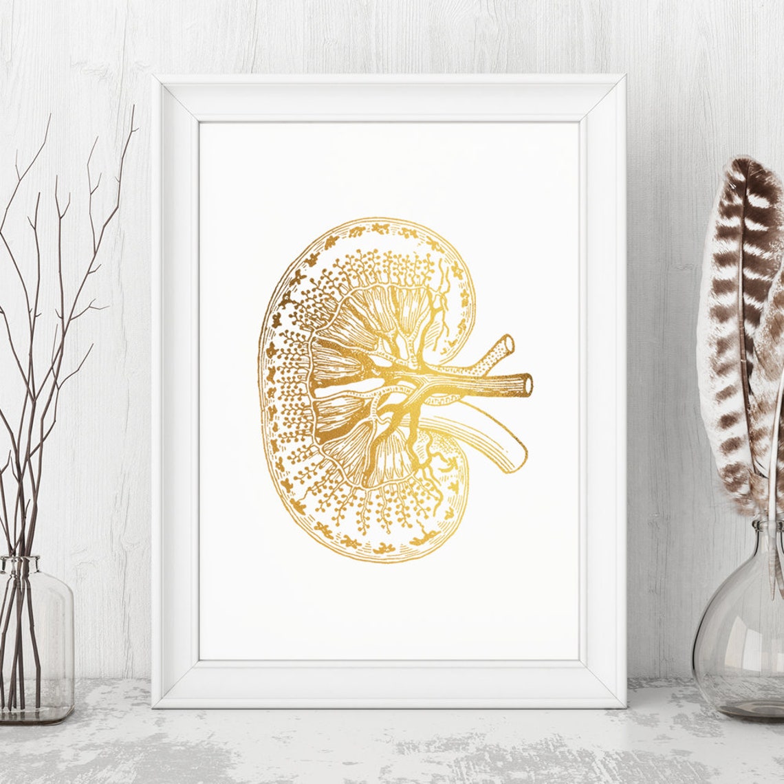 Gold Foil Kidney Anatomy Cross Section Nephrology Medical Art Print