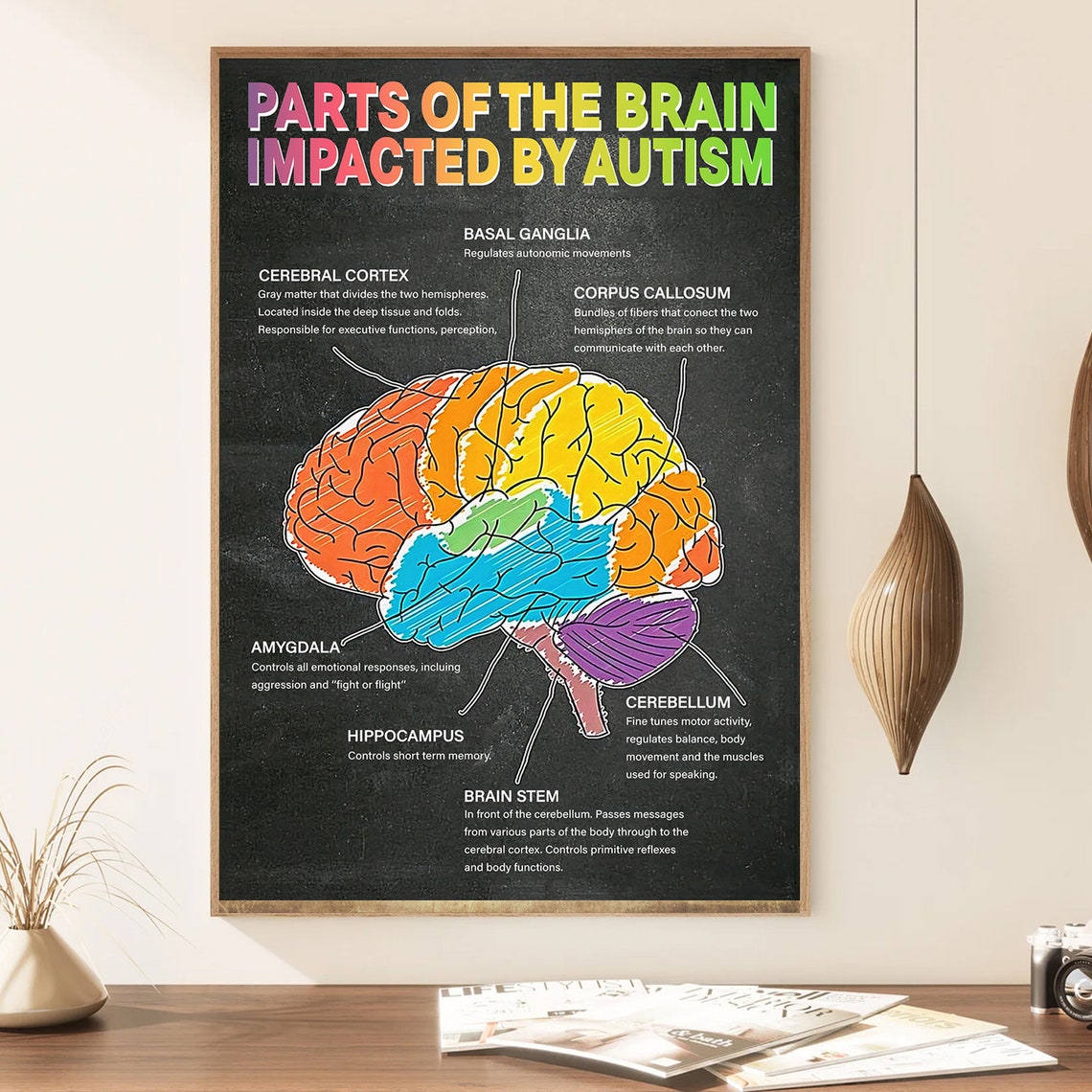 Parts of the Brain Impacted by Autism Educational Chart Poster - Image 3