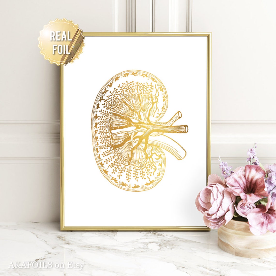 Gold Foil Kidney Anatomy Cross Section Nephrology Medical Art Print - Image 3