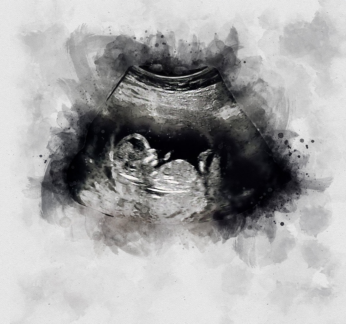 Baby Ultrasound Watercolor Sonogram Art Print