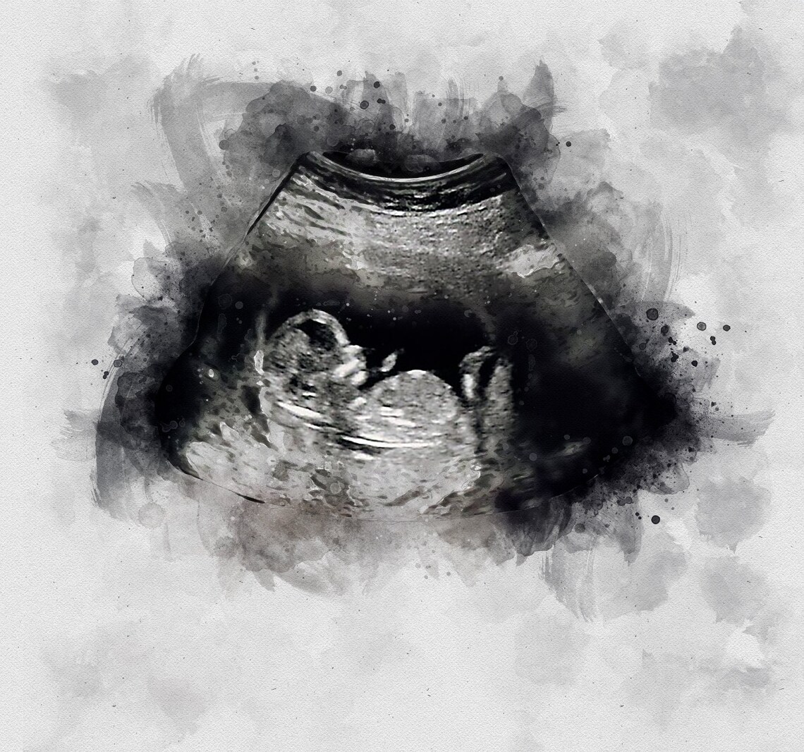 Watercolor Baby Ultrasound Sonogram Art Print - Image 4
