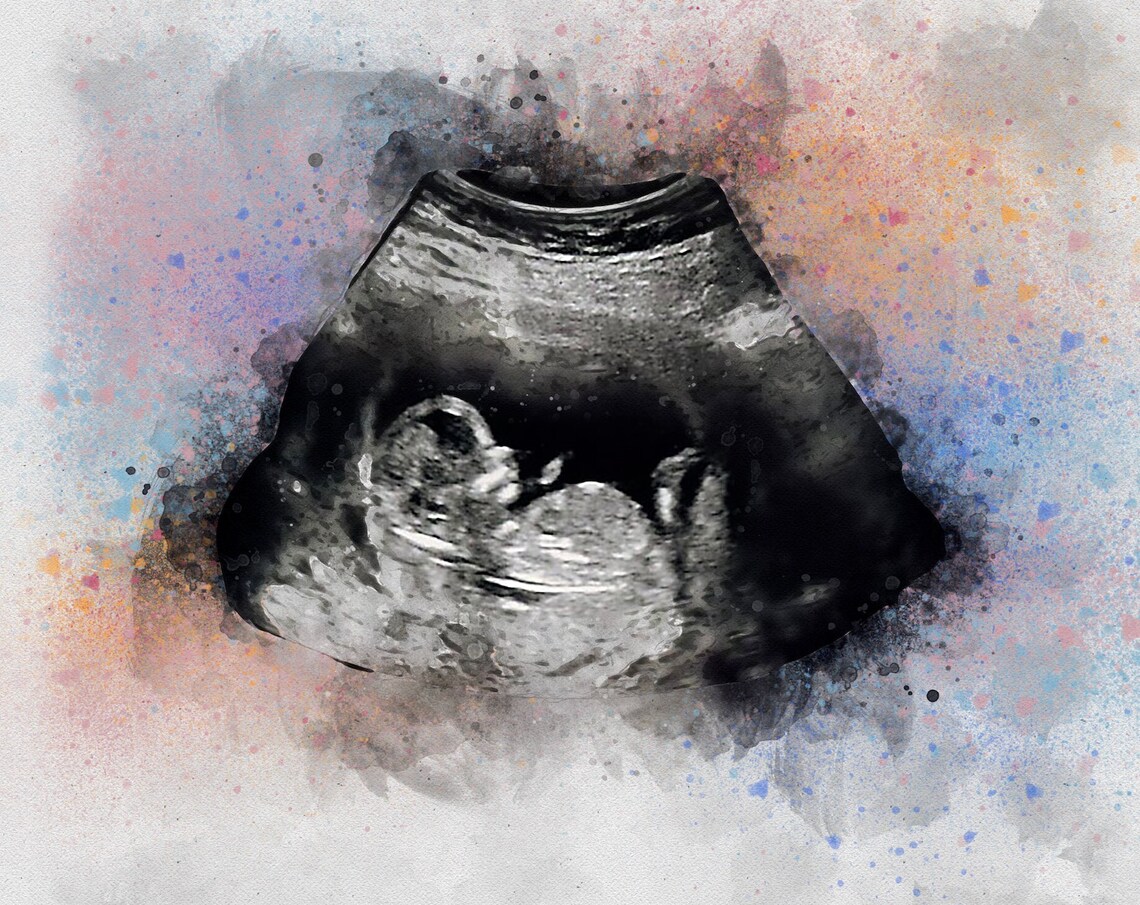 Watercolor Baby Ultrasound Sonogram Art Print