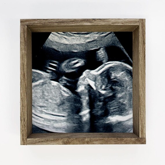 First Look Baby Ultrasound Scan Black and White Keepsake Poster