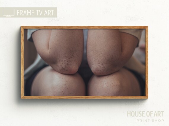 Freckled Skin Close Up Knees and Elbows Intimate Fine Art Photography Print
