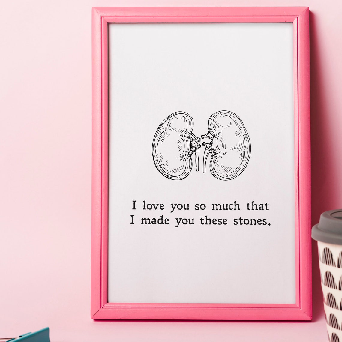 I Love You So Much That I Made You These Stones Kidney Joke Print