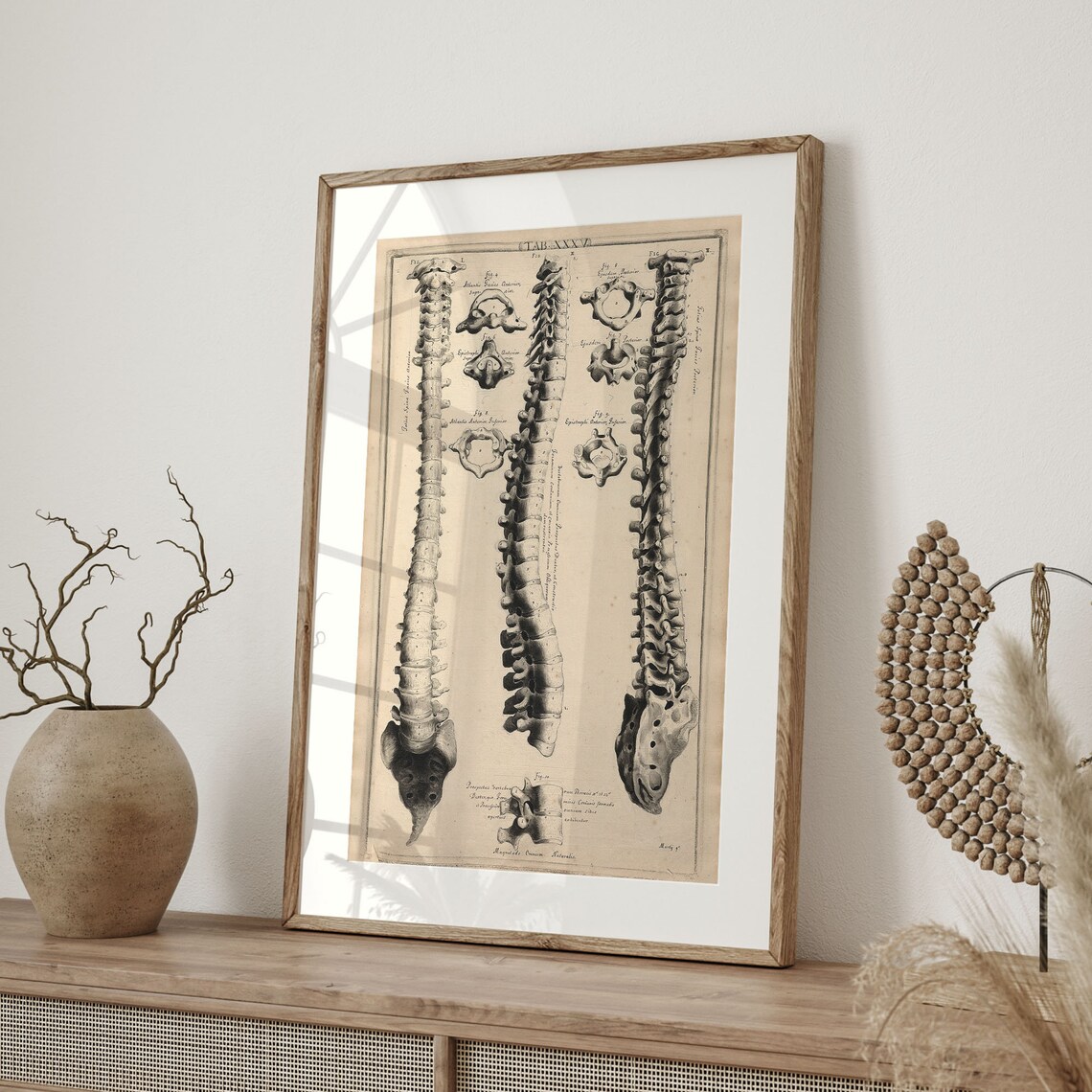 Antique Human Spine Anatomy Engraving Vintage Medical Skeleton Poster - Image 4