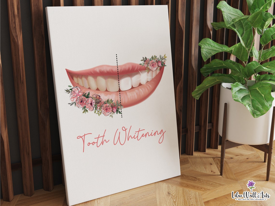 Tooth Whitening Pink Rose Smile Glow Cheerful Dentist Decor Art Poster - Image 2