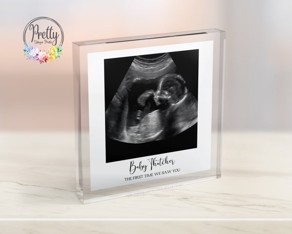 Personalised Baby Scan Keepsake Wall Art Print