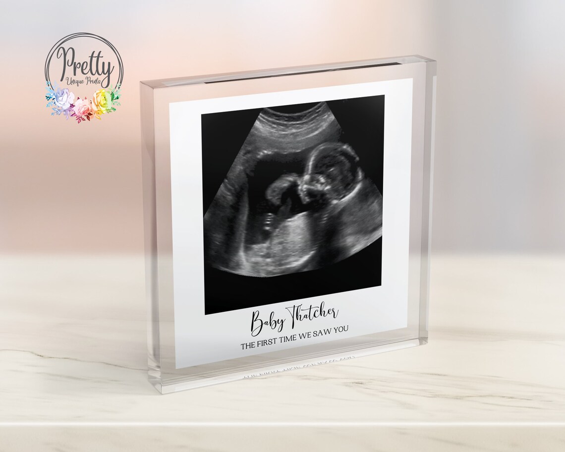 Personalised Baby Scan Keepsake Wall Art Print