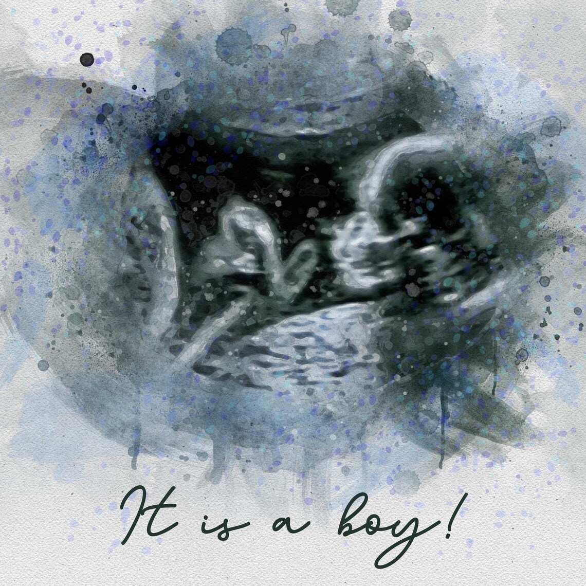 Custom Baby Ultrasound Watercolor Sonogram Art Print
