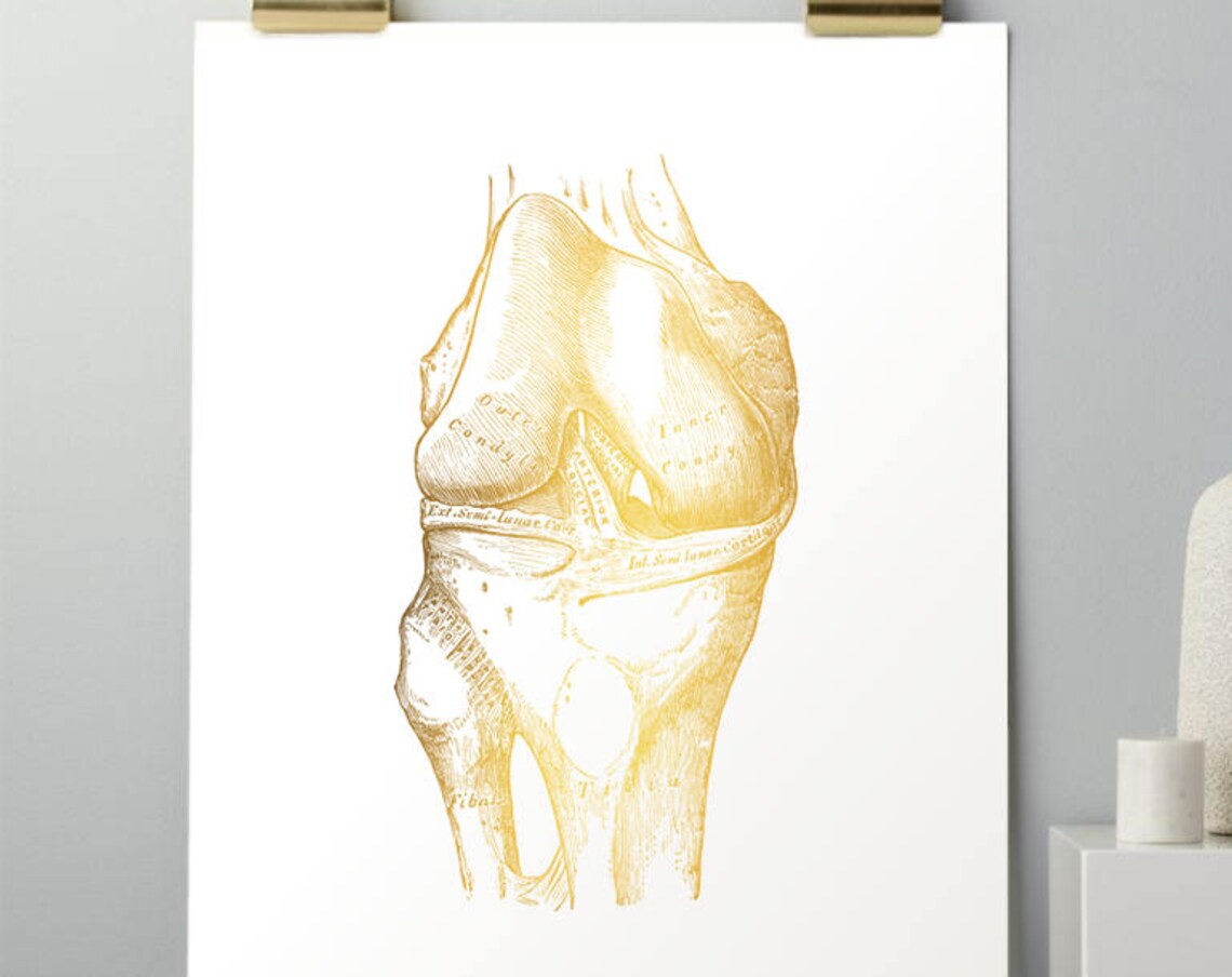 Gold Foil Knee Joint Anatomy Orthopedic Surgeon Vintage Art Print - Image 3