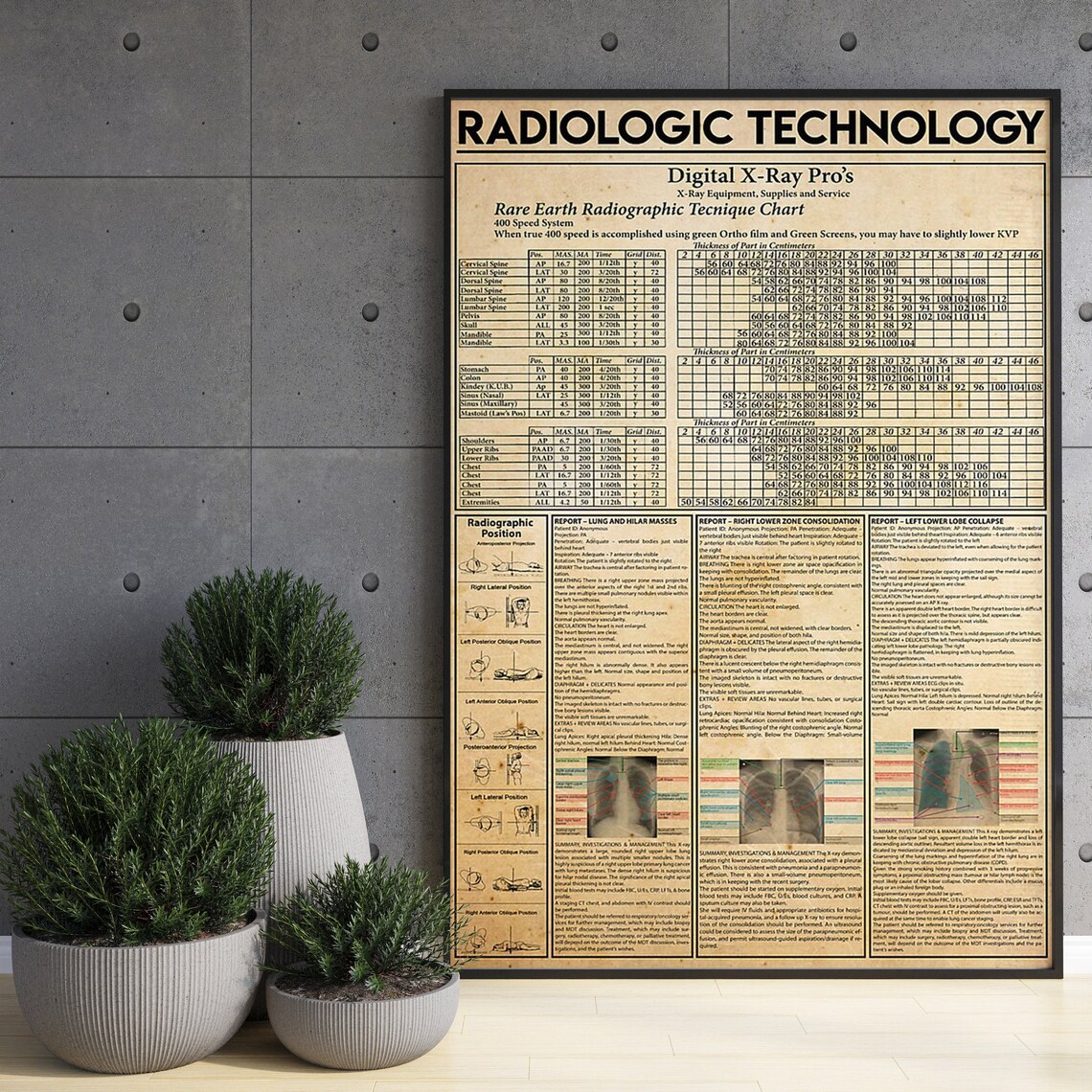 Radiologic Technology Knowledge Poster, Gift - Image 3